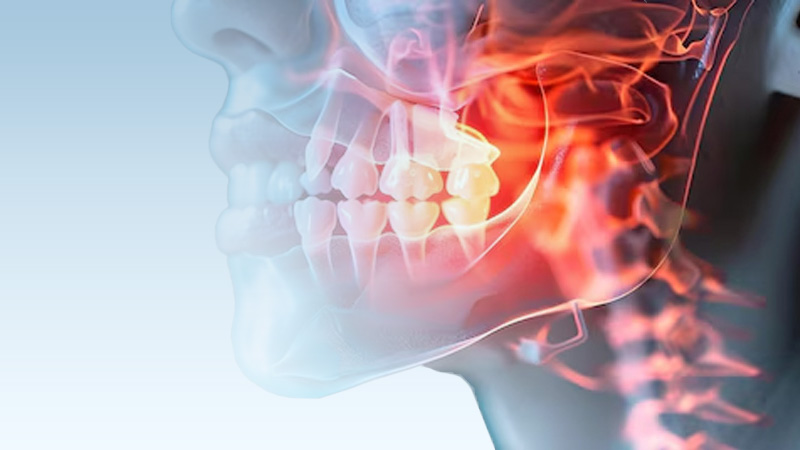 TMJ/Airway Dentistry at The Center for Dental Healing